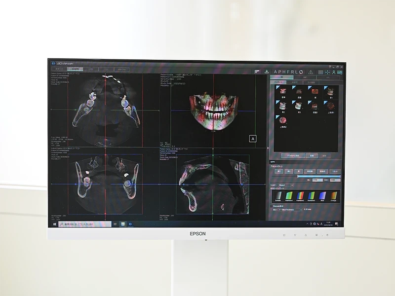 精密診断と低侵襲な治療