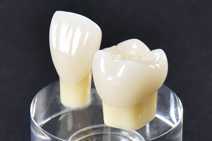 ジルコニアククラウン