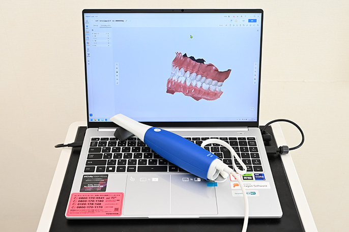 レーザー治療器